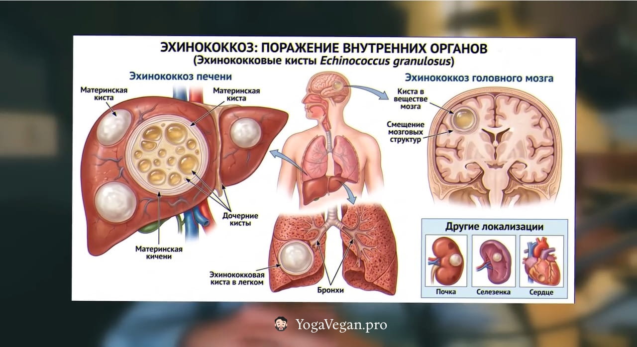 🎬 Как нас тихо и системно заражают паразитами